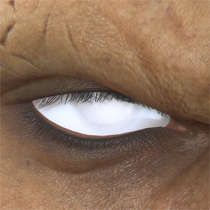 T_UI_CUS_CH_item_cht_eye_white