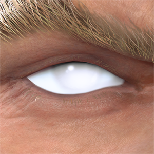 T_UI_CUS_CH_item_grf_eye_white