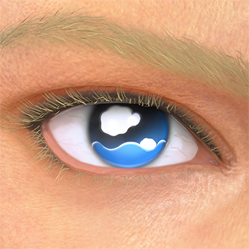T_UI_CUS_CH_item_ghp_eye_teary
