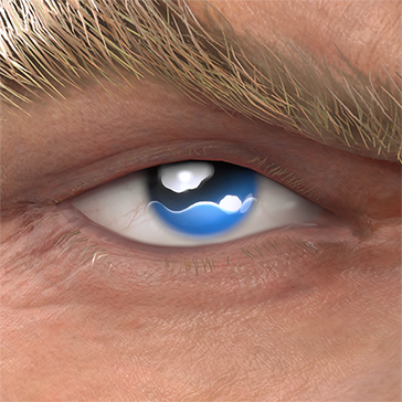 T_UI_CUS_CH_item_grf_eye_teary