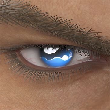 T_UI_CUS_CH_item_hrs_eye_teary