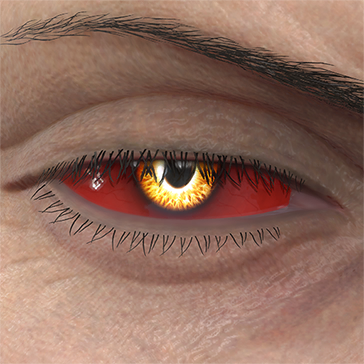 T_UI_CUS_CH_item_kmd_eye_vampire