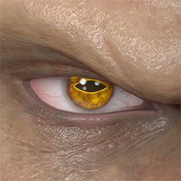 T_UI_CUS_CH_item_ccn_eye_toad