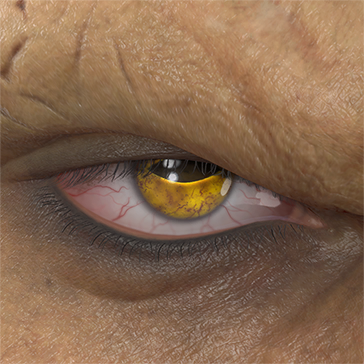 T_UI_CUS_CH_item_cht_eye_toad