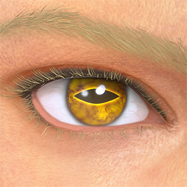 T_UI_CUS_CH_item_ghp_eye_toad