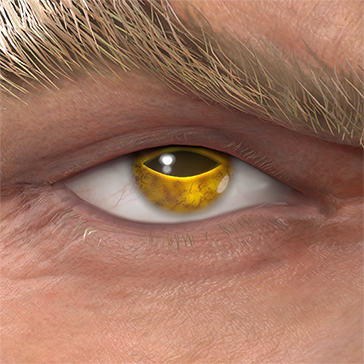 T_UI_CUS_CH_item_grf_eye_toad