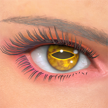 T_UI_CUS_CH_item_hms_eye_toad