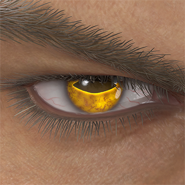 T_UI_CUS_CH_item_hrs_eye_toad