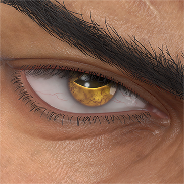 T_UI_CUS_CH_item_klw_eye_toad