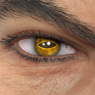 T_UI_CUS_CH_item_pig_eye_toad