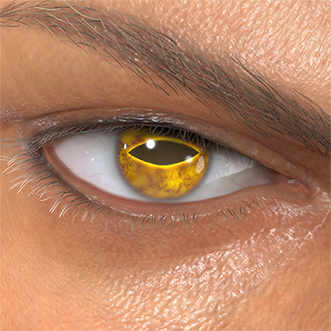 T_UI_CUS_CH_item_snk_eye_toad